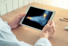Cirurgia de pé e tornozelo