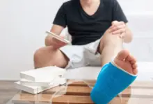 Cirurgia de tornozelo com placa e pino