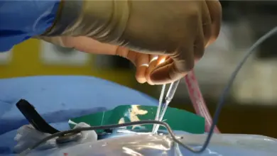 Cirurgia no pé minimamente invasiva