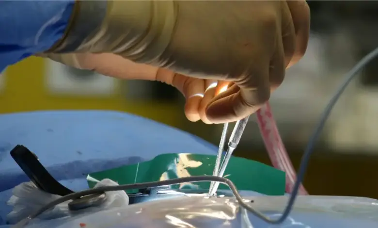 Cirurgia no pé minimamente invasiva
