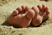 Cirurgia para diminuir o dedo do pé