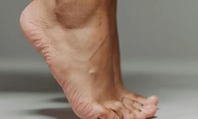 Coalizão tarsal