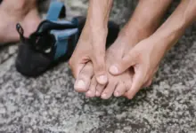 Dedo inchado e roxo por pancada