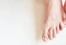 Dedo mindinho do pé quebrado