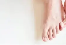 Joanete do quinto dedo