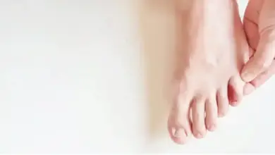 Joanete do quinto dedo