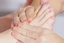 O que é bom para joanete