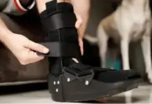 Recuperação da cirurgia de coalizão tarsal