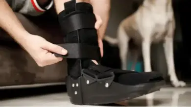 Recuperação da cirurgia de coalizão tarsal