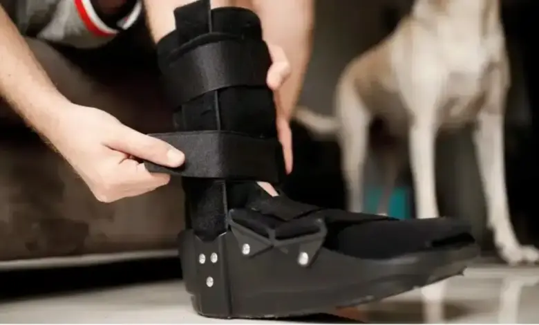 Recuperação da cirurgia de coalizão tarsal