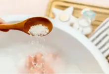 Remédio caseiro para joanete inflamado