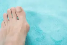 Tipos de joanete no pé