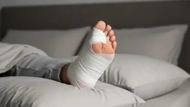 Pós-operatório da cirurgia de joanete