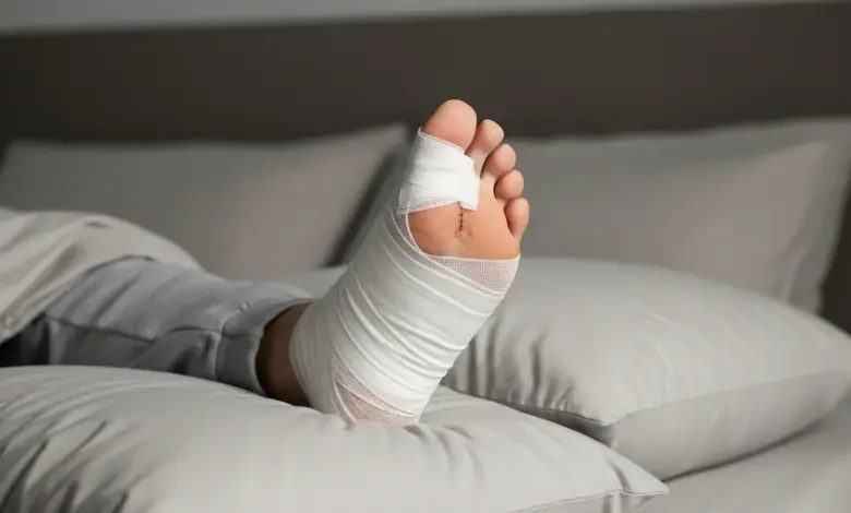 Pós-operatório da cirurgia de joanete