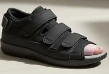 Qual o risco de cirurgia de joanete