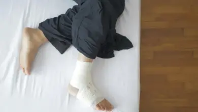 Quantos dias é a recuperação de cirurgia de joanete