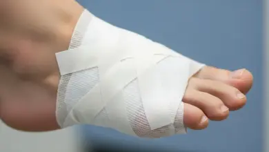 Quantos dias é a recuperação de cirurgia de joanete