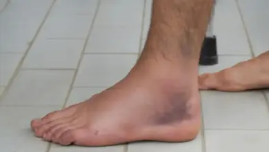 Distensão do tornozelo