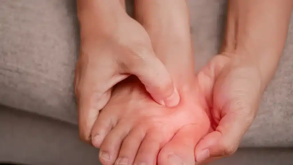 Joanete volta depois da cirurgia